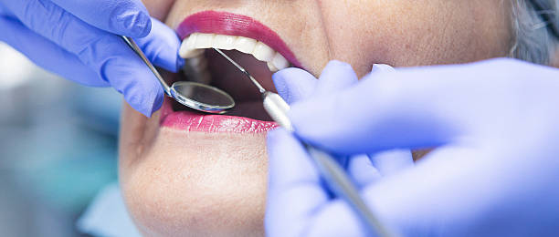 Best Urgent Care for Lost Fillings or Crowns in Pinconning, MI